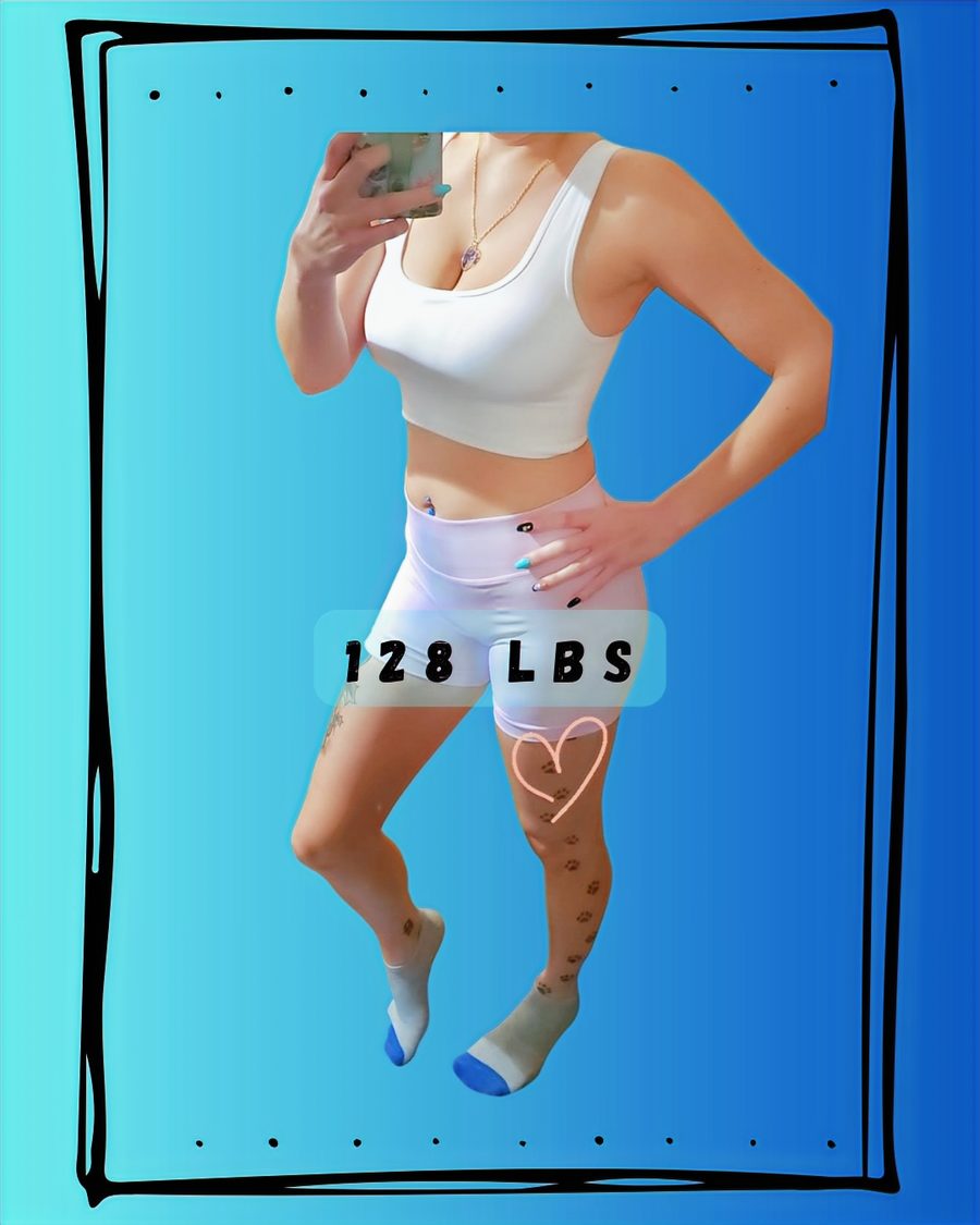 The same patient after a 70 lb weight loss.